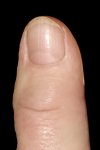 Margot's left thumb