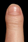 Peggy's left thumb