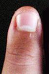 Tom's left thumb