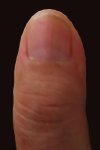 Wilfried's left thumb